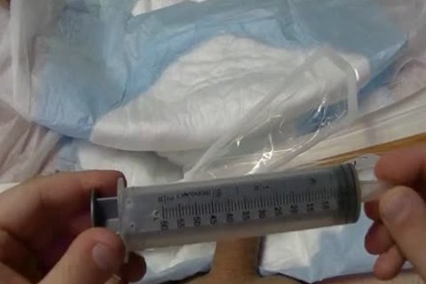 I insert A 24 French Catheter In Me. I Take In 500 ML Of Water In My Bladder. WhelLOLe My Bladder Is To The Bursting Point Play With Myself To The Poi