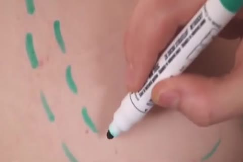 bare Medics 1 - Parte 04